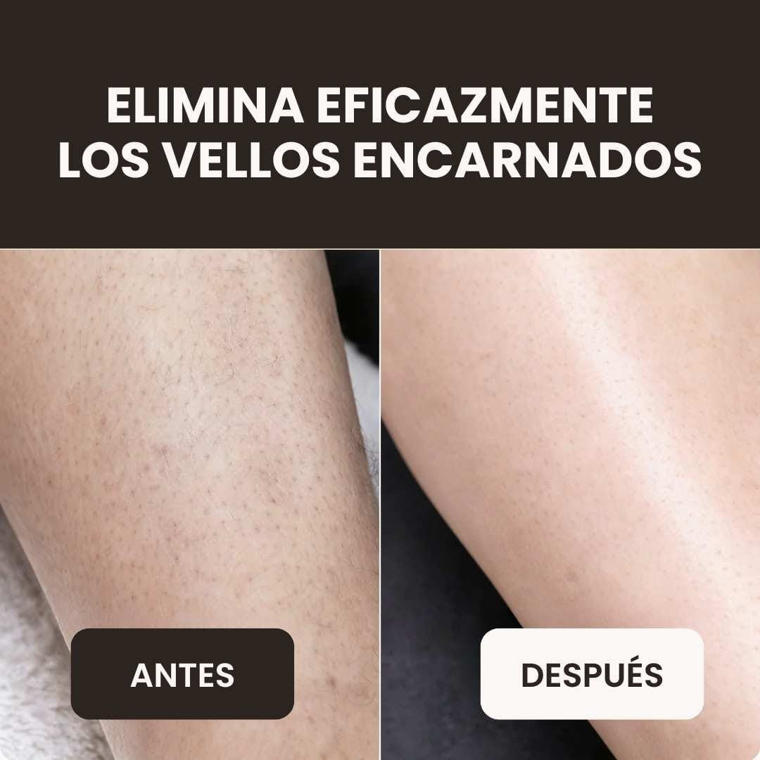 Rasuradora eléctrica Almelya