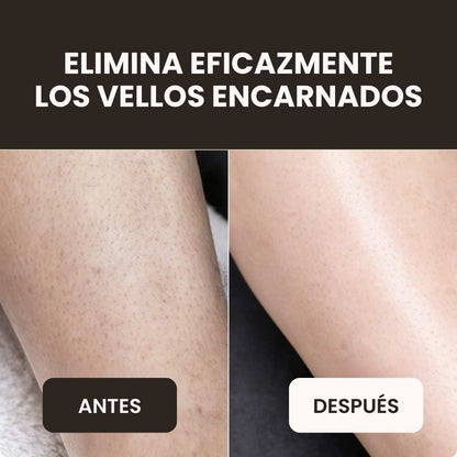 Rasuradora eléctrica Almelya